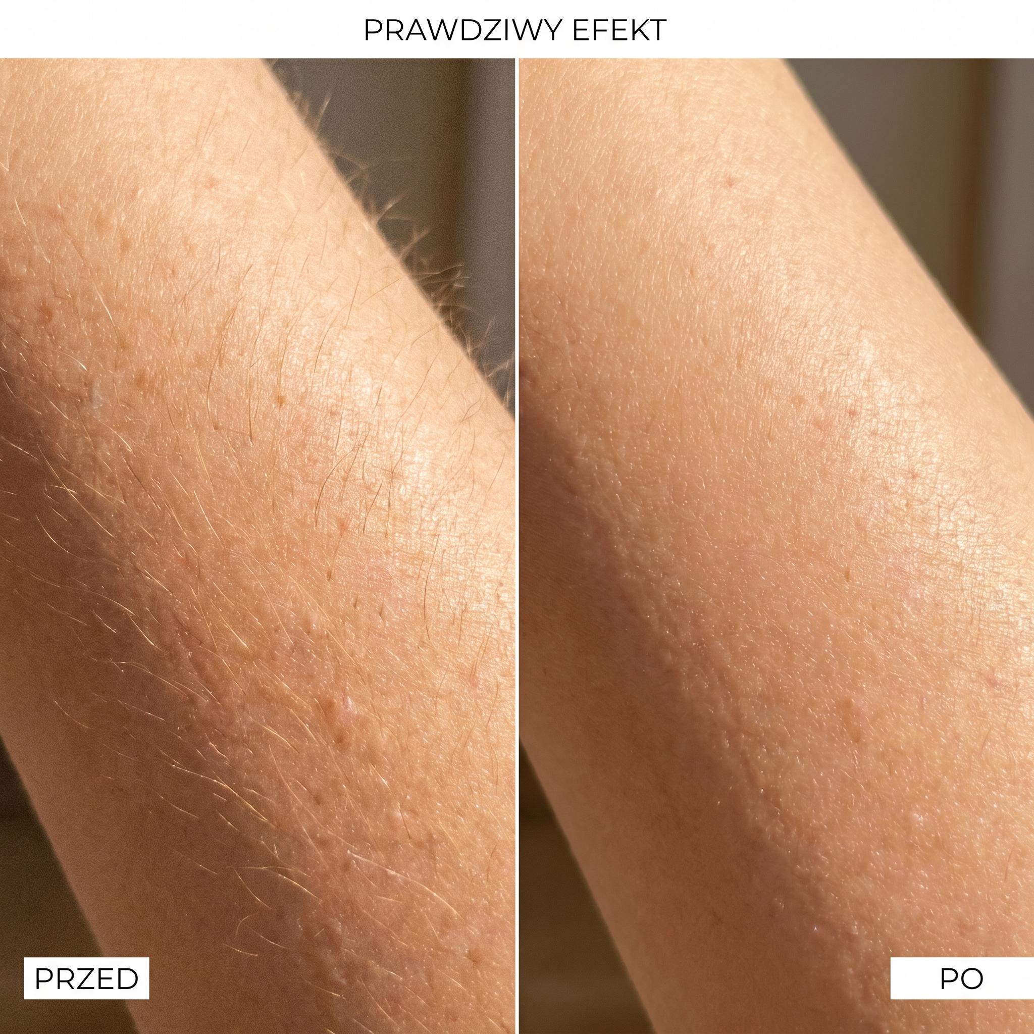 Reluxo Silk™ porównanie z innymi trymerami — lepsza golarka dla kobiet